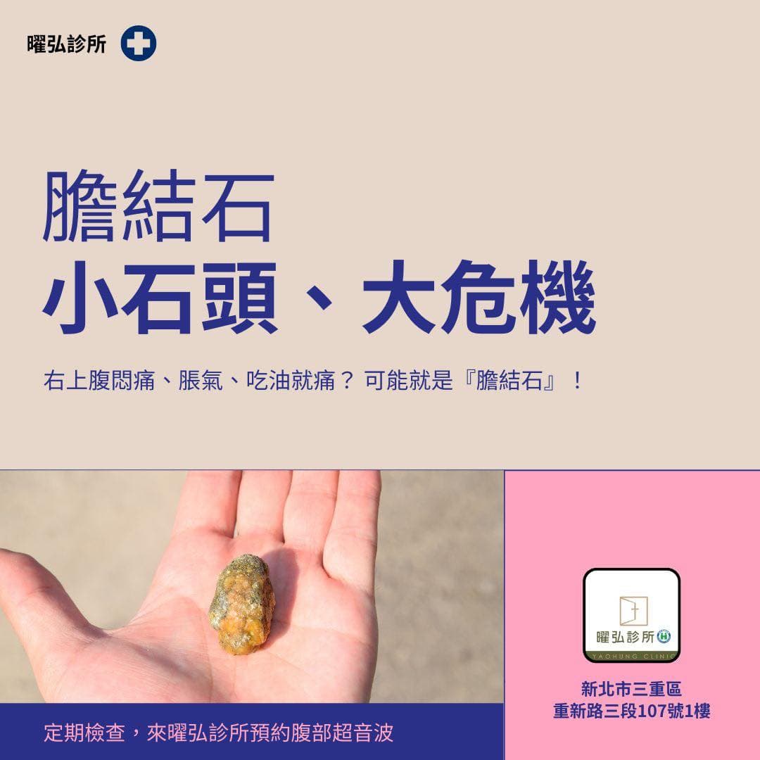 膽結石 —【小石頭,大危機】