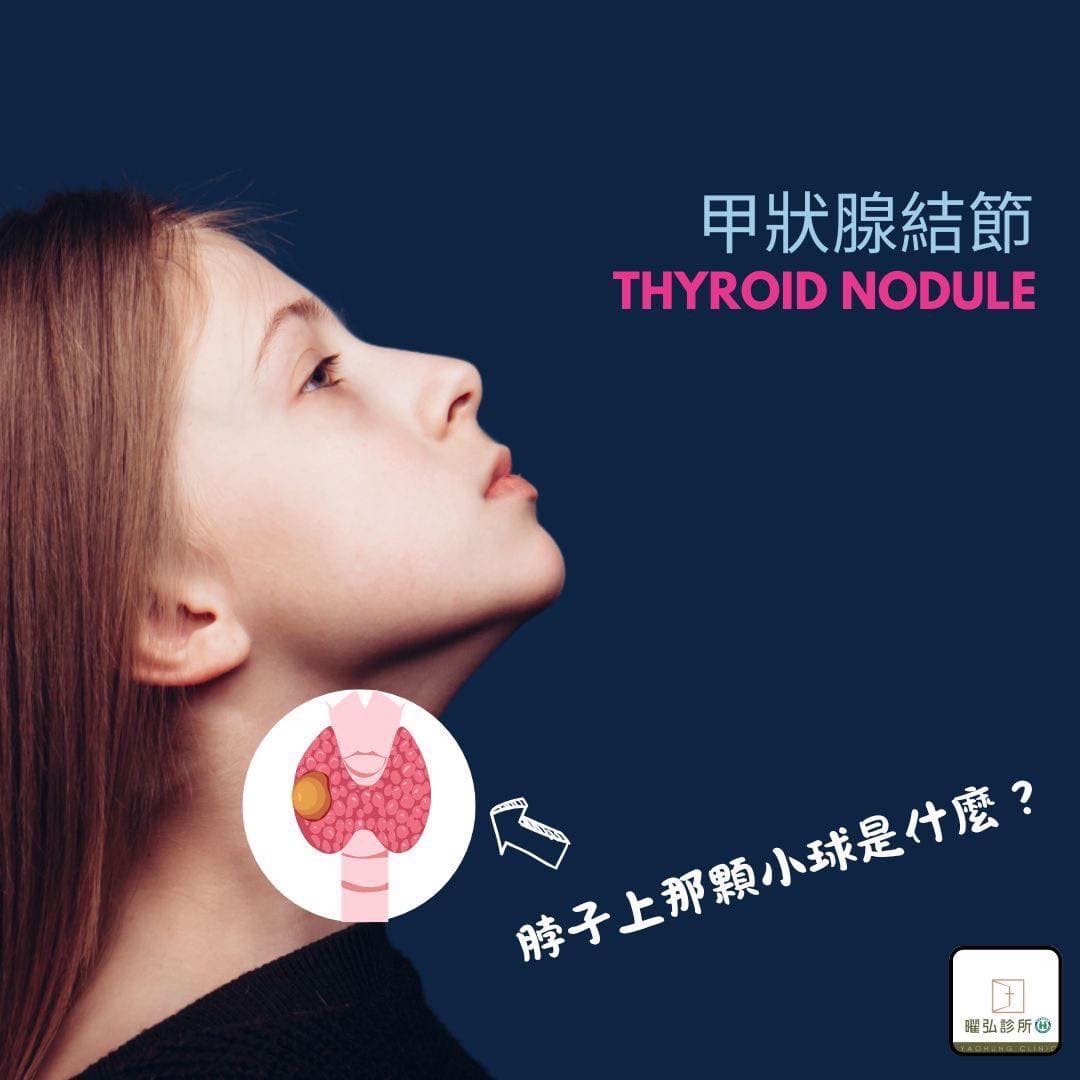 脖子那顆小「球」是什麼?🥲