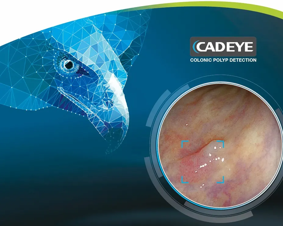 CAD EYE 內視鏡 AI 影像判讀